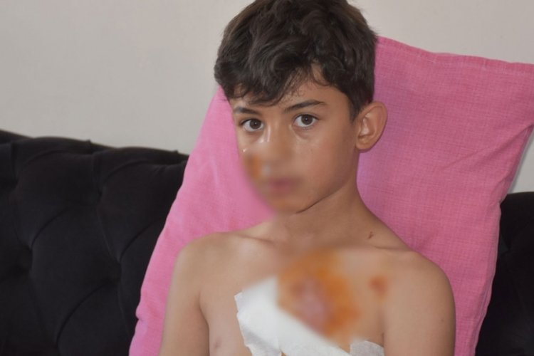 A&ccedil;ıkta kalan inşaat demiri, g&ouml;ğs&uuml;ne saplandı