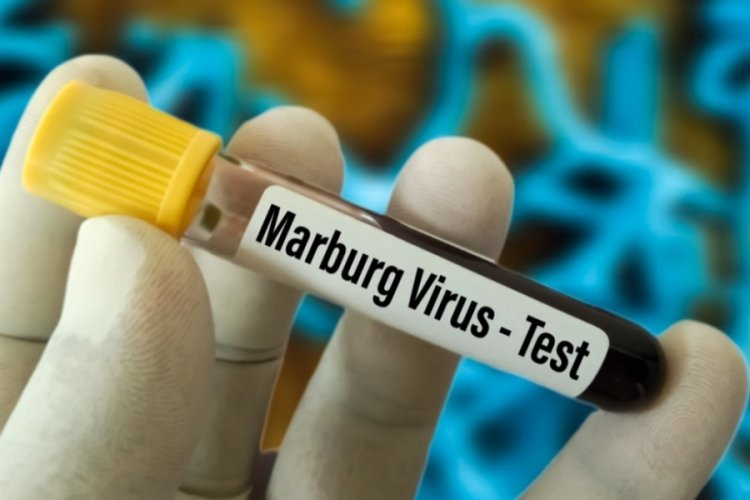 Marburg virüsü nedir, Marburg virüsü belirtileri nelerdir? 