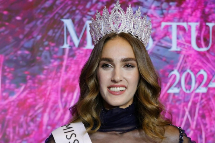 Miss Turkey birincisi İdil Bilgen'in son hali şoke etti: Estetik mi yaptırdı?