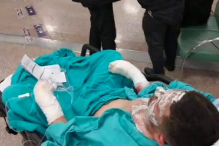 Yaktığı ateşe tiner döken genç ağır yaralandı