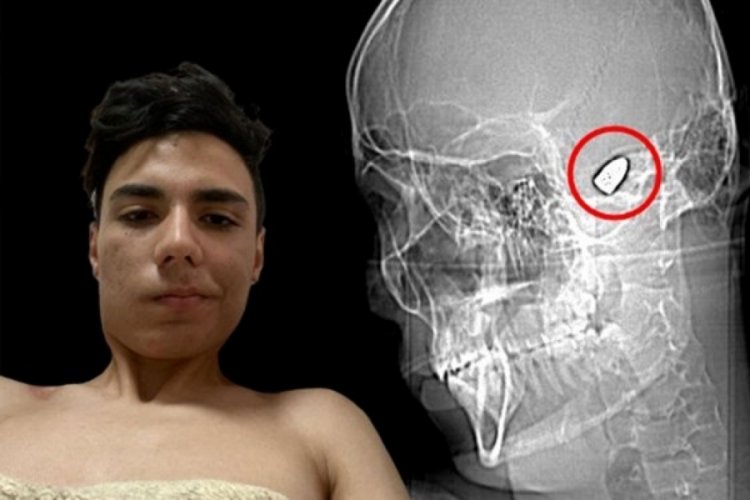 Kafasının içinde patlamaya hazır bomba ile dolaşıyor