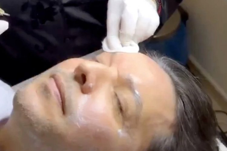 Nihat Doğan estetik işlem yaptırdı
