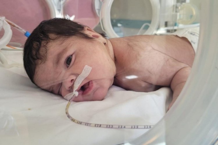 Bebeğin boynundan 445 gram tümör çıkarıldı