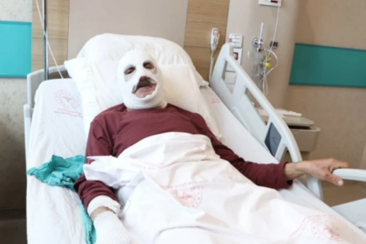 Bingöl'de gaz kaçağını çakmakla kontrol eden yaşlı adam hastanelik oldu