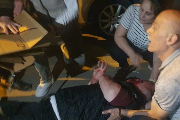 Emekli polisin yüzüne minibüs aynası çarptı