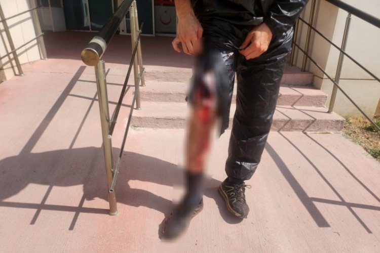 Bursa'da kendini kesme vakaları bitmiyor!