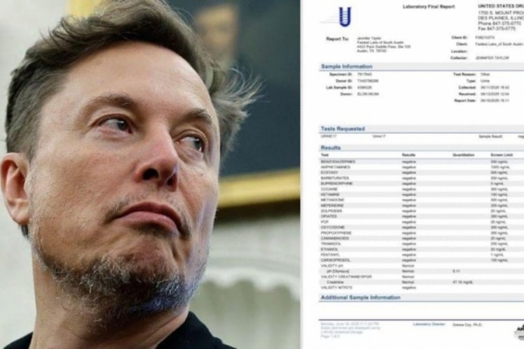 Elon Musk idrar testini paylaştı