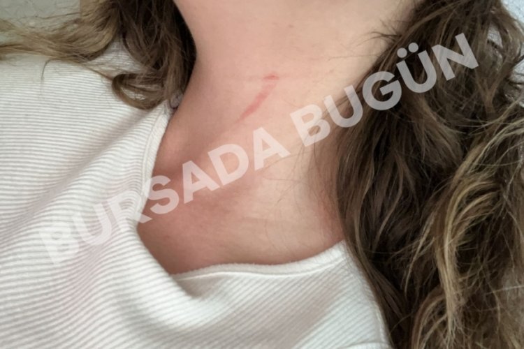 Şiddet, bıçak, gasp! Bursa'nın göbeğinde genç kadın dehşeti yaşadı...