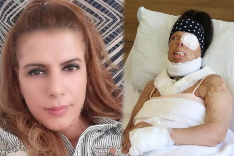 Eski sevgiliden uykuda kezzap vahşeti! Her satırı korkunç...