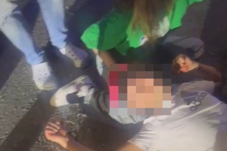 Feci kazada ağır yaralandı! Arkadaşı dizine koyup bekledi