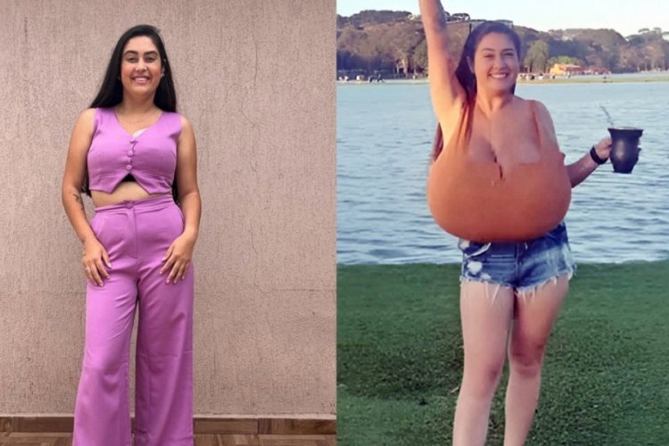 Göğüsleri aylar içinde 12 kiloya ulaştı!