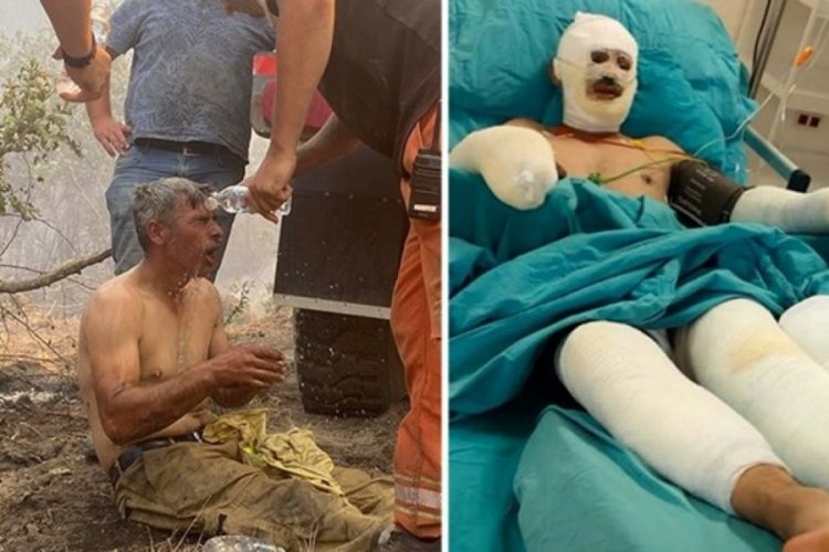 "Yanıyorum" diye feryat eden orman işçisinin tedavisi sürüyor 