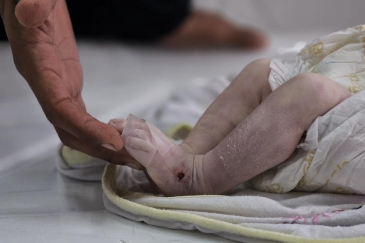 İsrail ablukasındaki Gazze'de bir bebek daha açlıktan hayatını kaybetti!