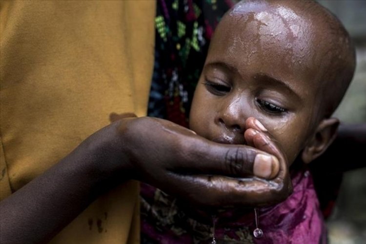 Sudan'da kolera kaynaklı ölümler artıyor!