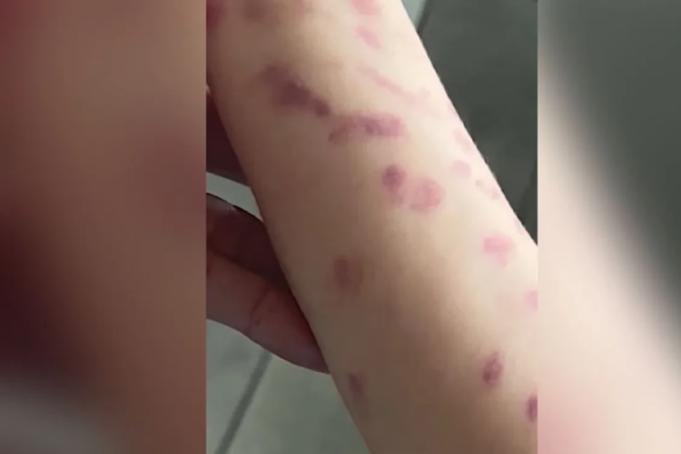 Akvaryum gezisi kabusa dönüştü! Dev ahtapot küçük çocuğun kolunu kaptı
