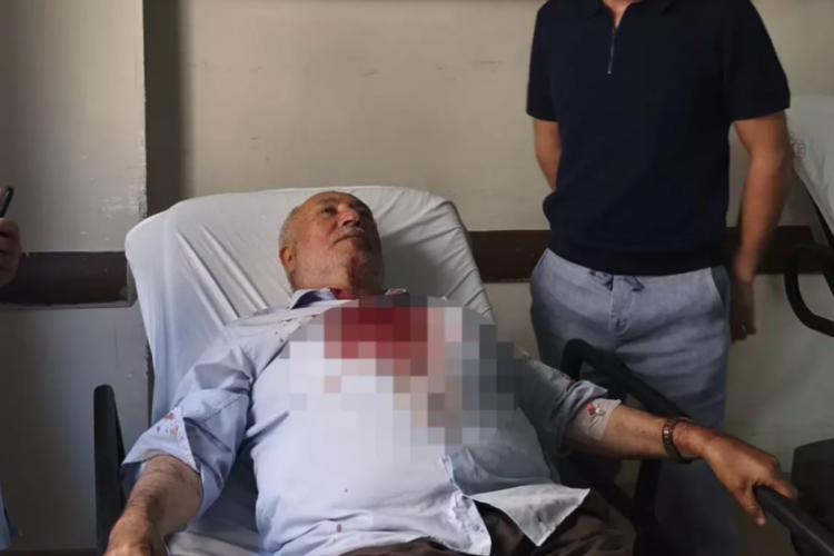 İmam kavga ayırırken yaralandı