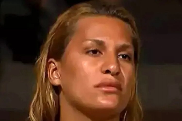 Survivor Almeda Baylan trafik kazası geçirdi!