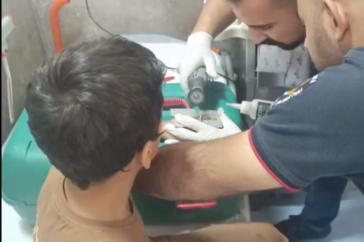 Çocuğun parmağına sıkıştırdığı cıvata pulu kesilerek çıkartıldı 