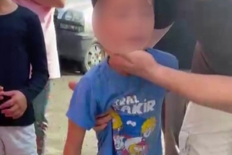 6 yaşındaki çocuk başıboş sokak köpeklerinin saldırısına uğradı