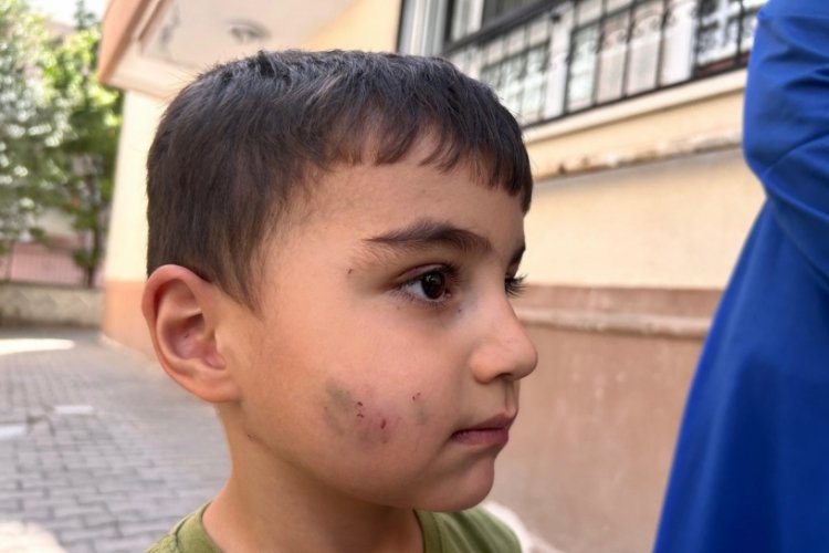 Evde uyuyan çocuğu lağım faresi ısırdı