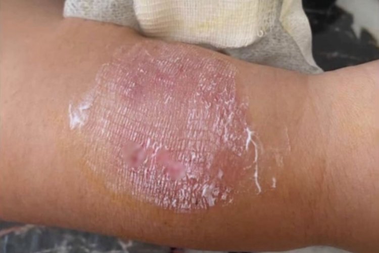 Büyükçekmece'de sigara dumanı tartışmasında kolunu ısırdı