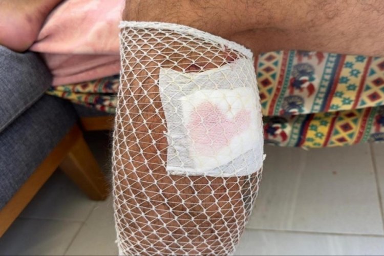 Yürüyüş yaparken başıboş sokak köpeklerinin saldırısına uğradı