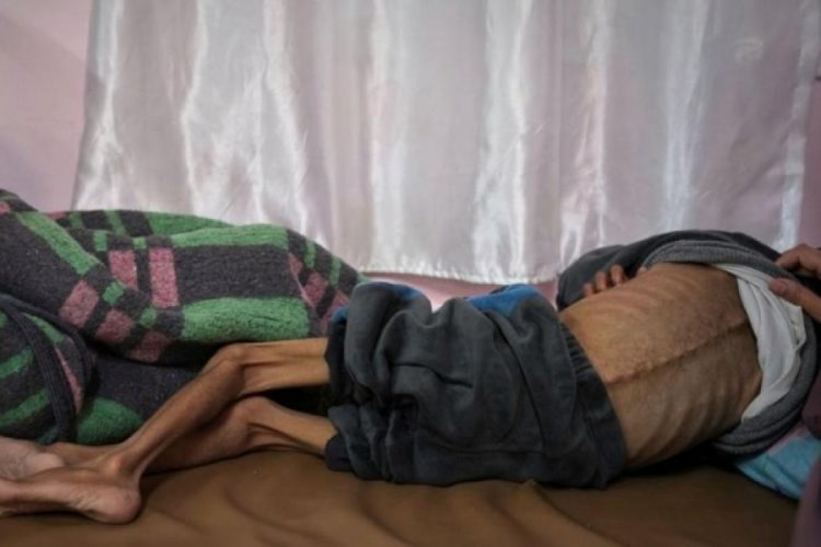 Gazze'de son 24 saatte 3'ü çocuk 9 kişi daha açlıktan hayatını kaybetti