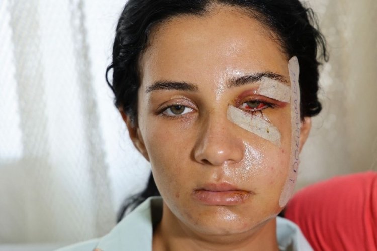 Adana'da boşandıktan sonra şiddet gören kadın: Yaşarken kurtulayım, öldükten sonra değil