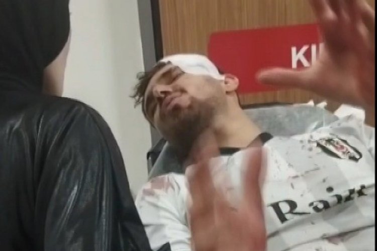 Mahalle maçı kavgaya dönüştü: 2 yaralı