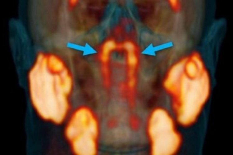 Bilim insanları insan vücudunda yeni organ buldu!