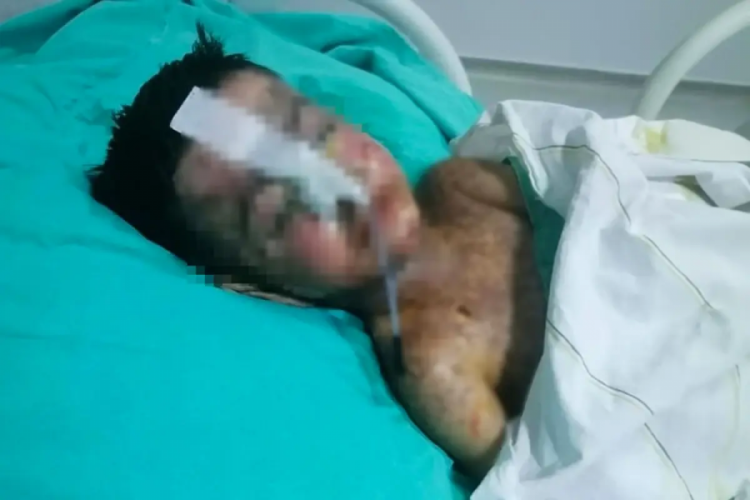 Salatalık yutunca korkunç gerçek ortaya çıktı! 3 yıl böyle yaşamış...
