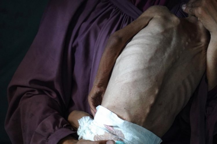 İsrail'in kıtlığı dayattığı Gazze'de son 24 saatte 5 kişi daha açlıktan hayatını kaybetti.