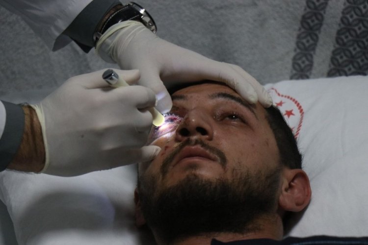 Düğün eğlencesi kabusa döndü: Sağ gözünden oldu