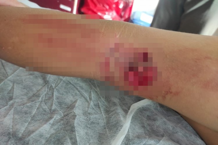 Bursa'da sahipsiz k&ouml;pek &ccedil;ocuğa saldırdı