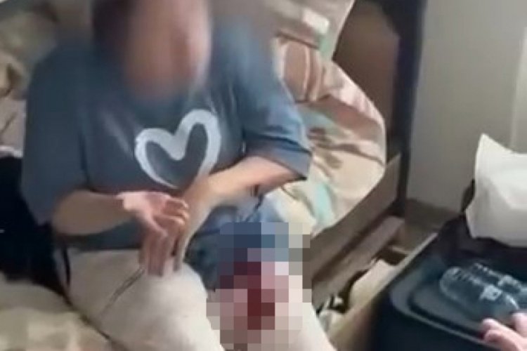 Kız &ouml;ğrenci yurdunda bı&ccedil;aklı kavga! 1 yaralı var...