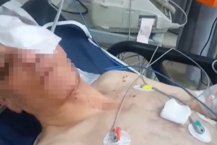 Pompalı t&uuml;fekle &ccedil;evreye ateş etti! 1'i polis 4 kişiyi yaraladı...