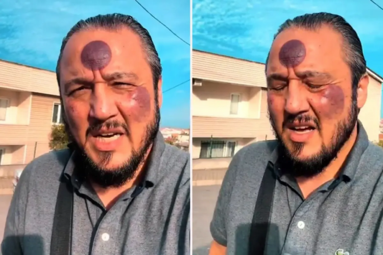 Meşhur uygulama y&uuml;z&uuml;n&uuml; bu hale getirdi! Yine de savundu...