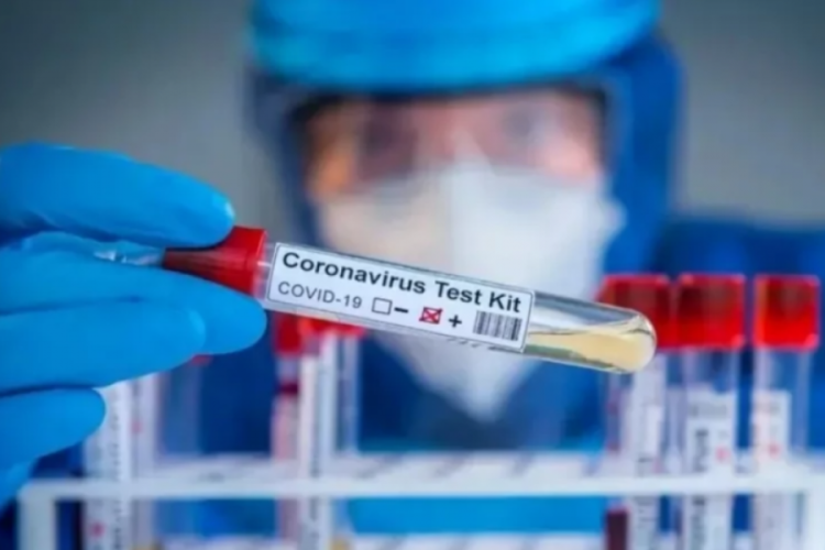 Araştırmaya göre uzun Covid'in sırrı kan pıhtısında