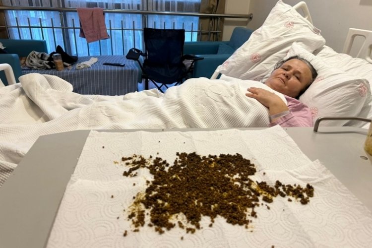 Hastadan çıkan taşları sayamadılar