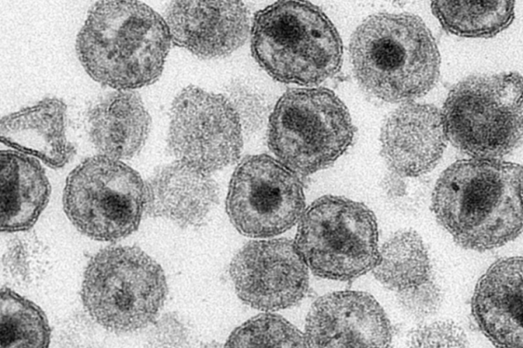 Dünyada 40 milyon 800 bin kişi HIV virüsü taşıyor