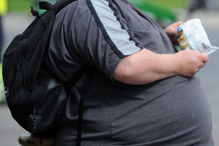 DSÖ, dünya genelinde bir milyardan fazla kişinin obezit...