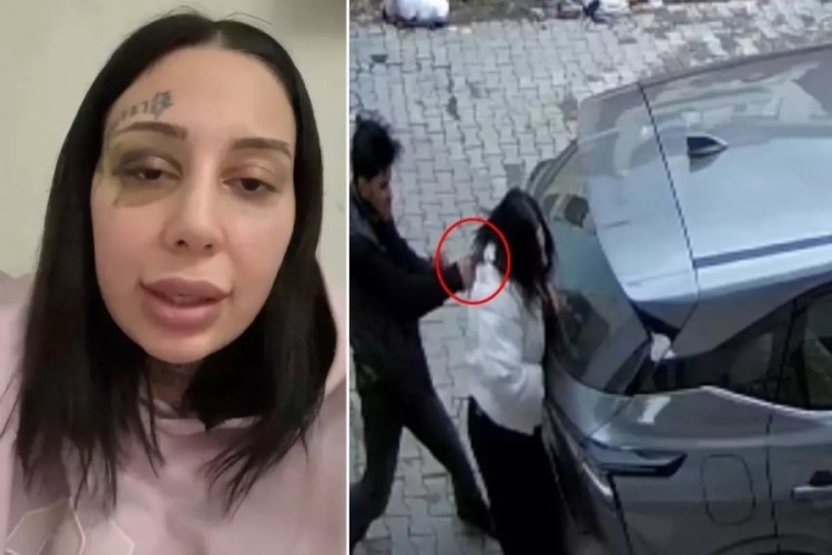 Sokak ortasında dehşeti yaşattı: Tecav&uuml;ze uğradım...