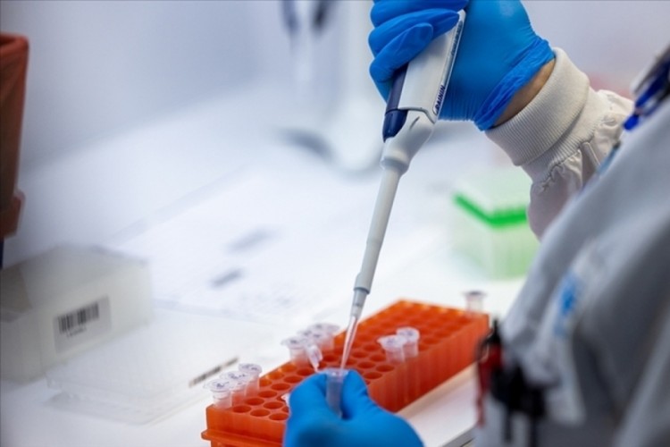 Madagaskar'da M Çiçeği vaka sayısı 78'e yükseldi