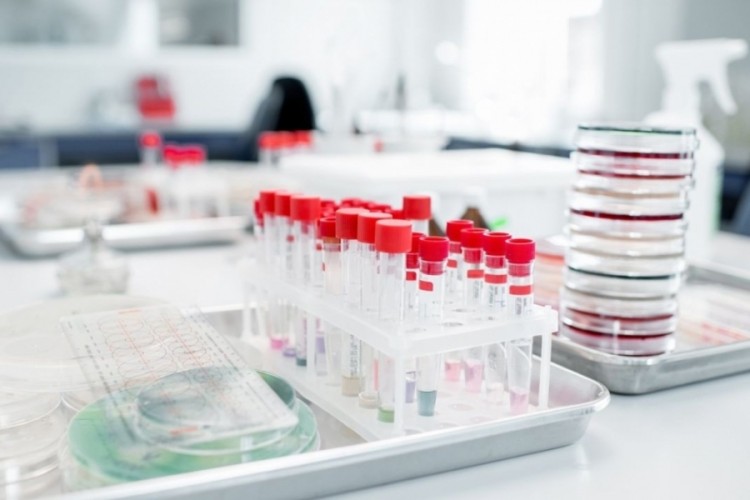 Hiç belirti vermeden kalbi çürütüyor: Dünya ölümcül vir...