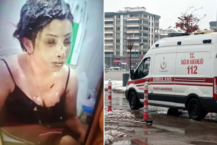 Bunun adı saf k&ouml;t&uuml;l&uuml;k! Eşini koli bandıyla bağlayıp kezzapla yaktı