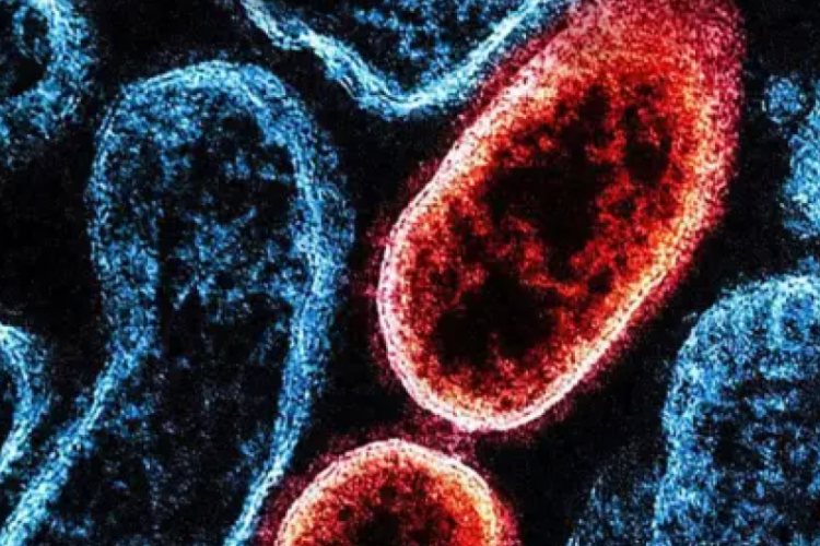 Kovid-19'dan çok daha ölümcül! | Nipah virüsü nedir, be...