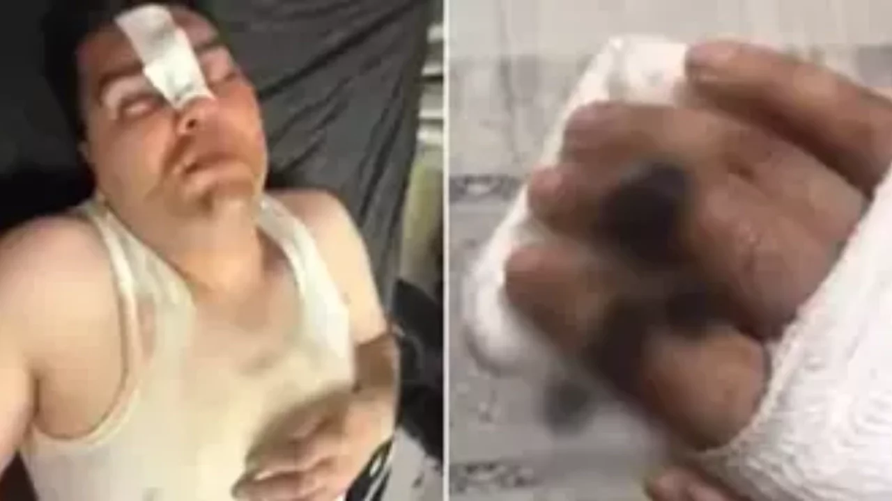 Hesabı ortak ödediler, dayağı tek başına yedi! Her şey 13 binlik "çerez" ile başladı