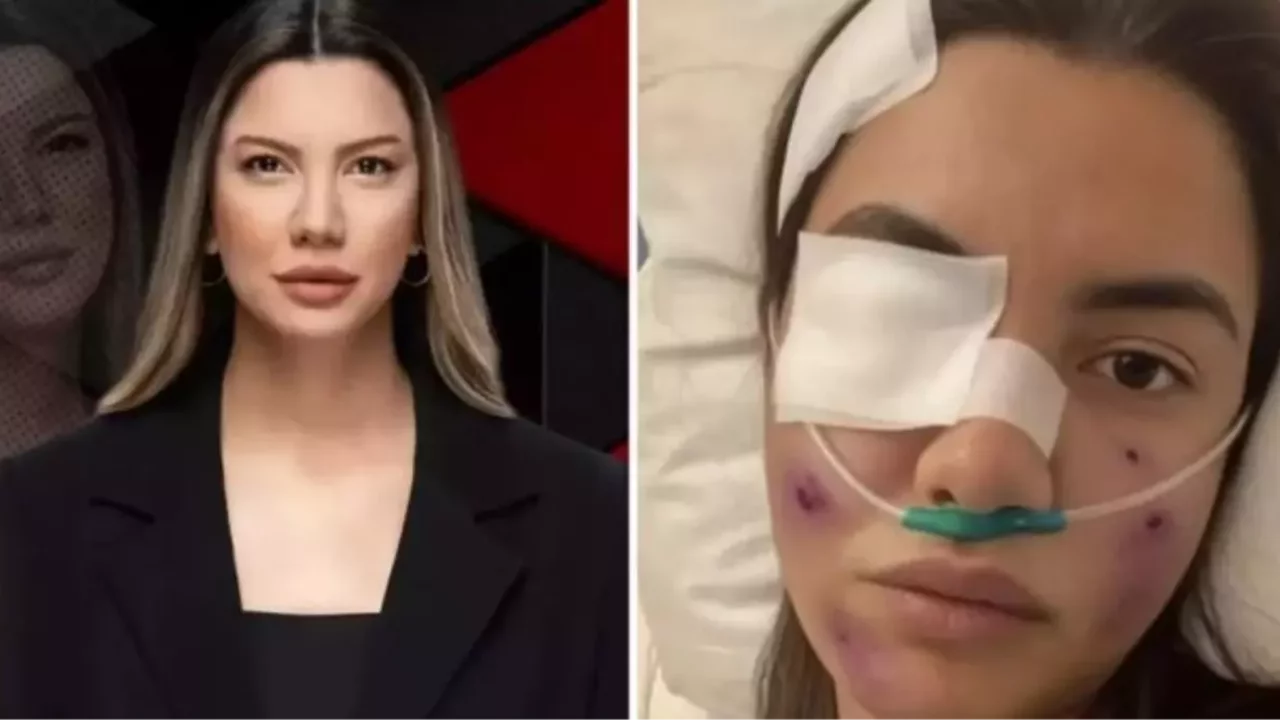 Fulya Öztürk trafik kazası mı geçirdi, görüntüler yapay zeka ile mi yapıldı? Fulya Öztürk ne açıklama yaptı?