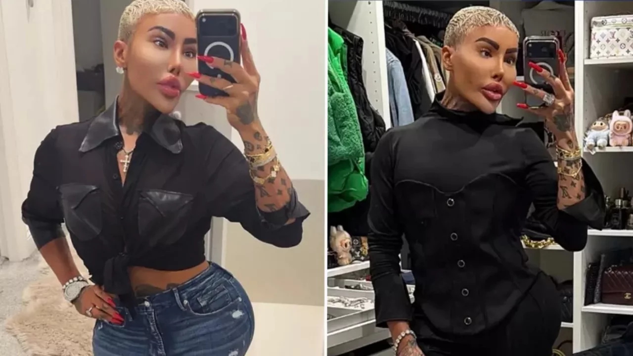 Kim Kardashian'a benzemek için estetik yaptıran fenomen hayatını kaybetti