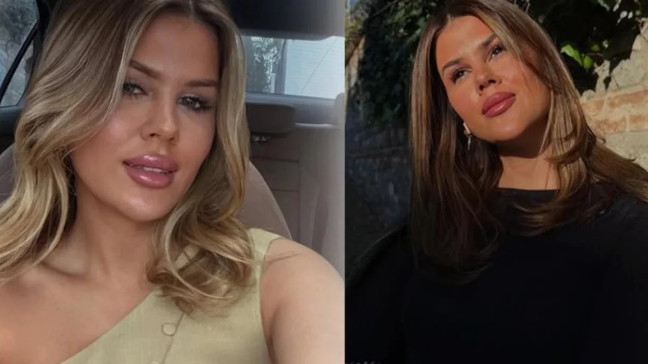 Mehmet Ali Erbil ile boşanmasının ardından değişime başladı! Gülseren Ceylan dolgularını eritti 